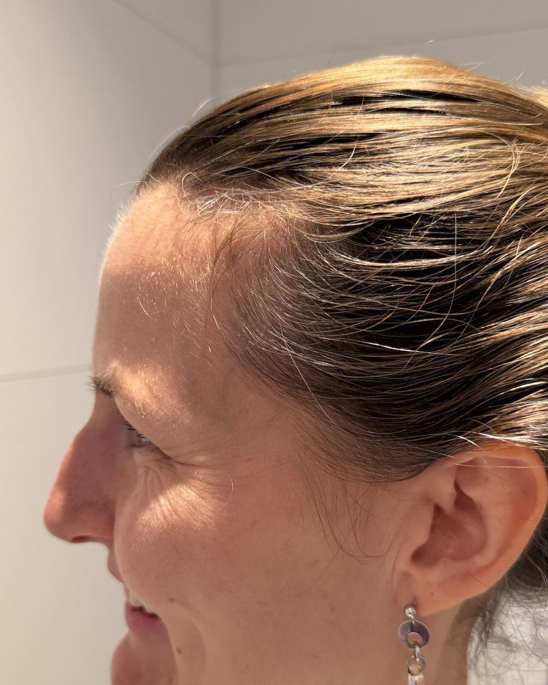 Geheimratsecken Frau: Daniella Schmid heute mit zurückgebundenen Haaren, Schläfe frei