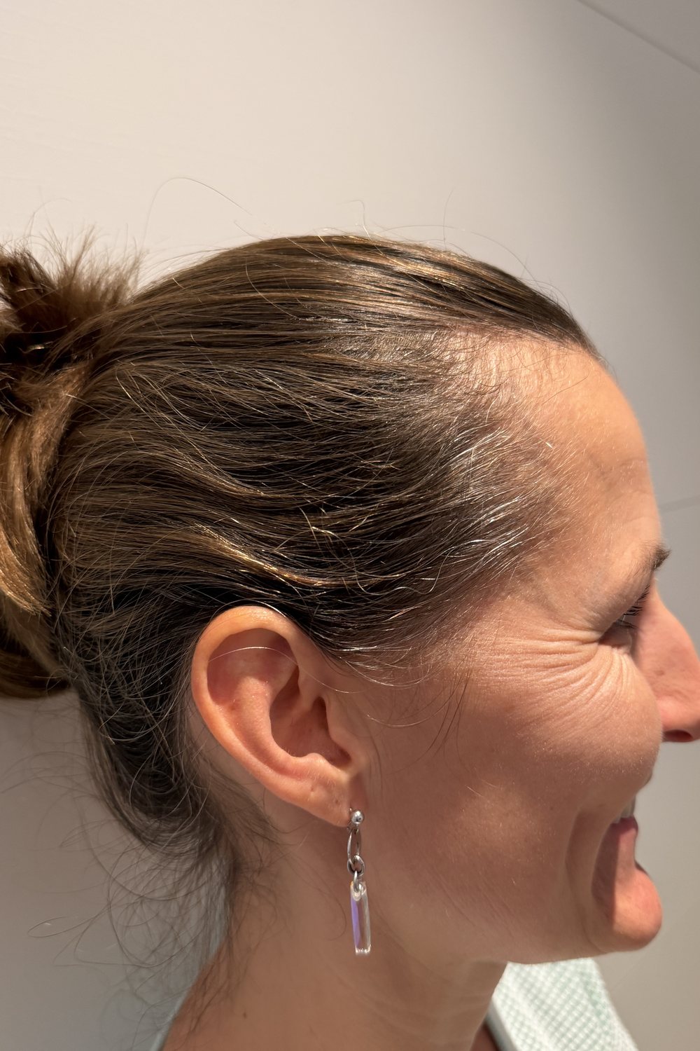 Geheimratsecken Frau: Daniella heute mit zurückgebundenen Haaren, Pin zum Merken für später