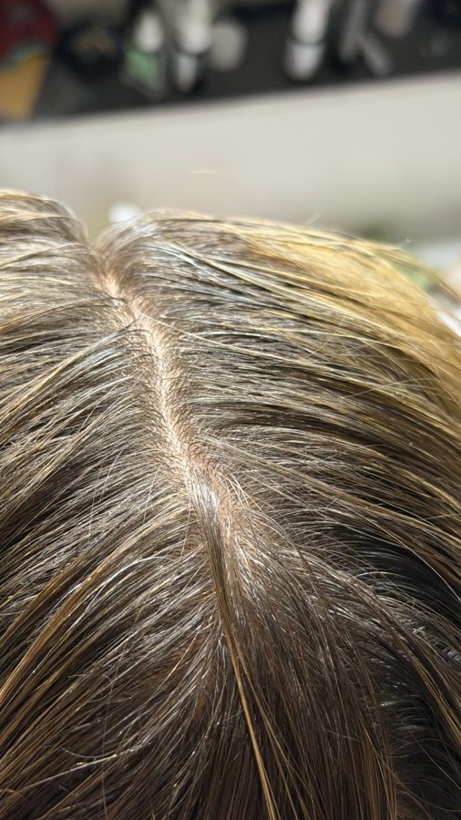 Kopfhautpeeling — Nahaufnahme meines Scheitels vor der Anwendung
